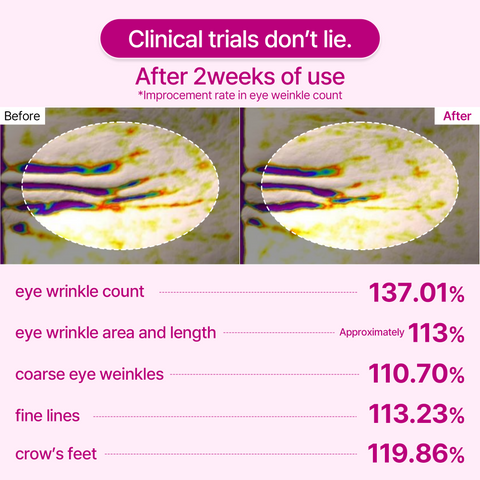 Leviri Calcium Volume Eye Patches
