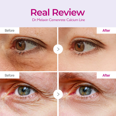 Leviri Calcium Volume Eye Patches