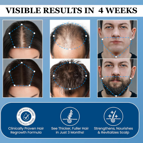 Leviri Hair Growth Roll-On Serum