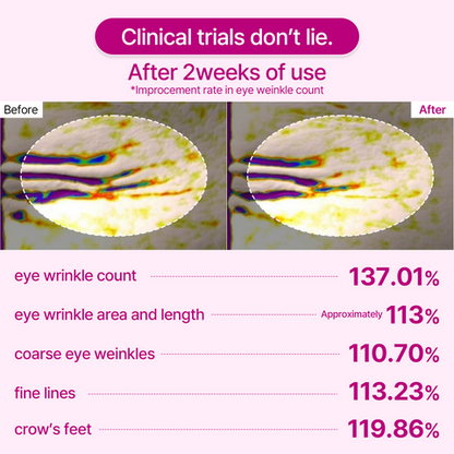 Leviri Calcium Volume Eye Patches