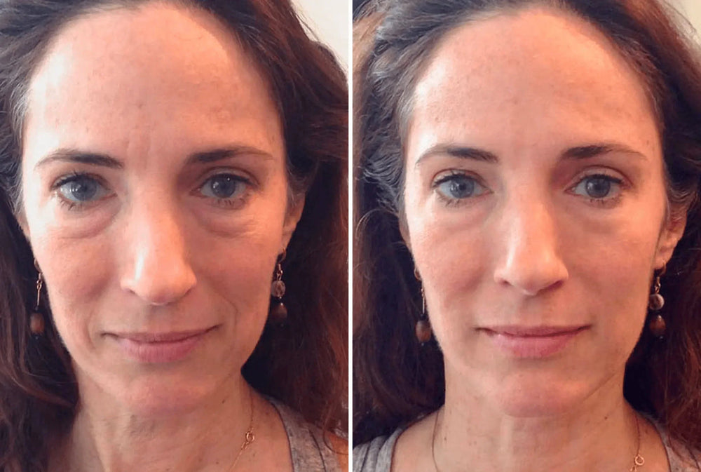 <h2>Loved by everyone, everywhere. Don't miss out.</h2>