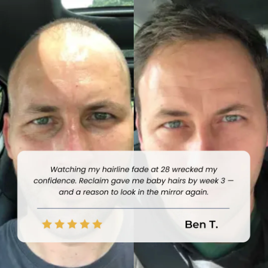 Leviri Hair Growth Roll-On Serum