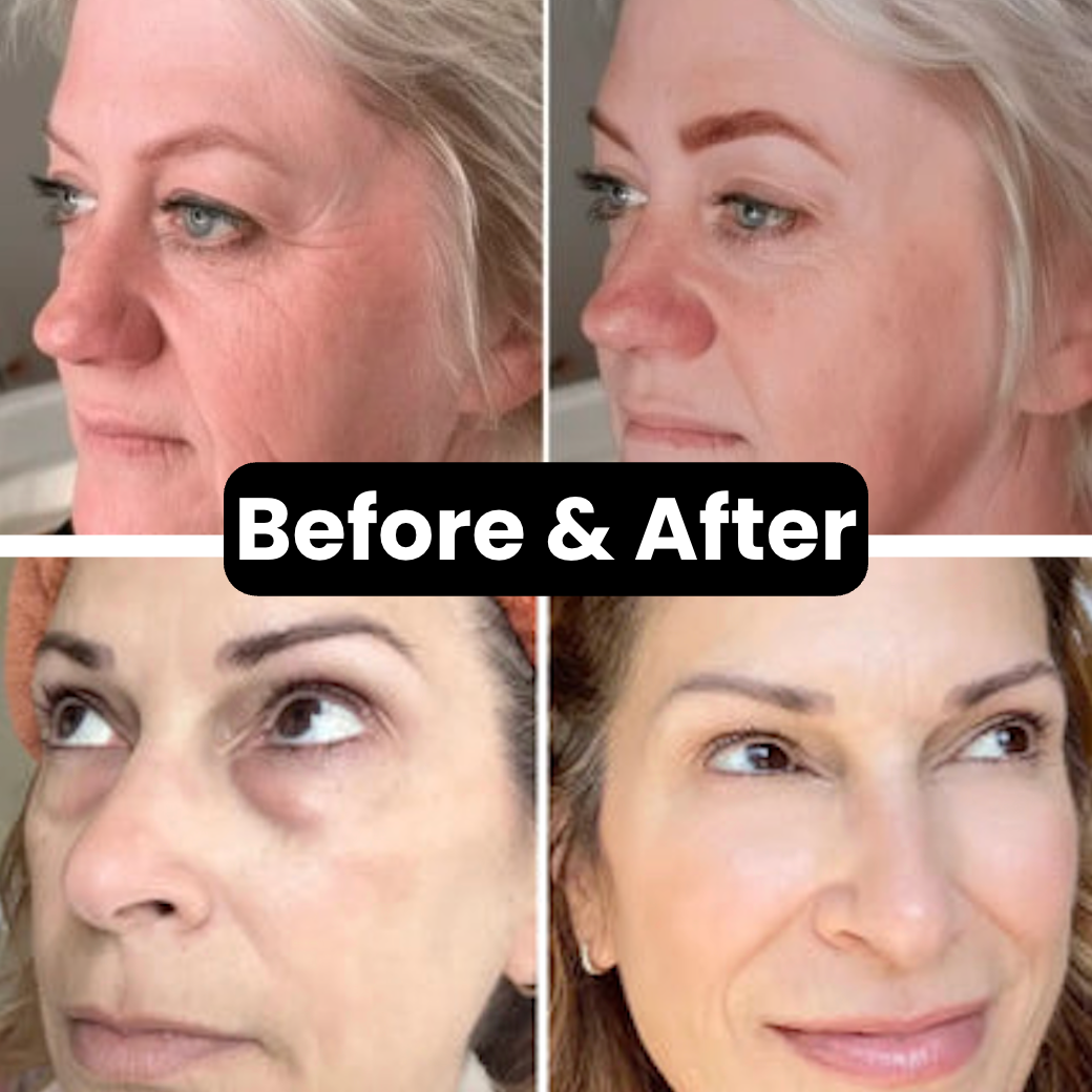 Leviri Anti-aging Calcium Multi Balm