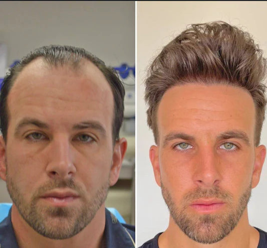 <h2>Loved by everyone, everywhere. Don't miss out.</h2>