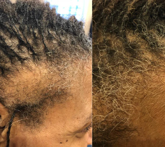 <h2>Loved by everyone, everywhere. Don't miss out.</h2>