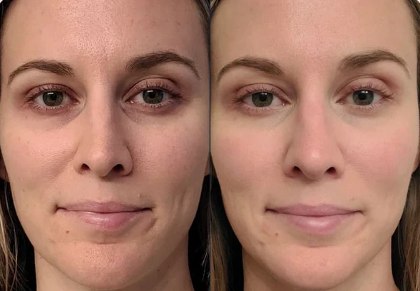 <h2>Loved by everyone, everywhere. Don't miss out.</h2>